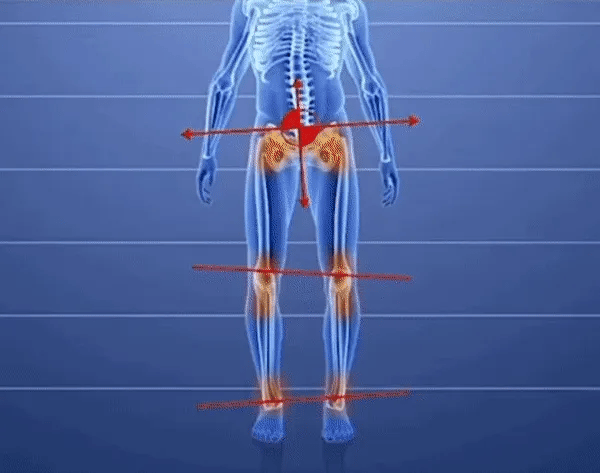 CLOUNDE | Priporoča zdravnik | Podpora za stopalni lok | Dvojno udobje 👞