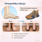 CLOUNDE® - Medicinski športni čevlji za starejše | Lajšanje bolečin | Mehka penasta podplat